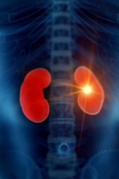 Organ Nakli: Yeni Bir Hayatın Kapısını Aralamak